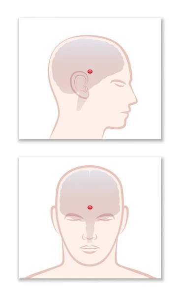 Pineal Gland Profile Frontal View Location Human Brain Isolated Vector — Stock Vector