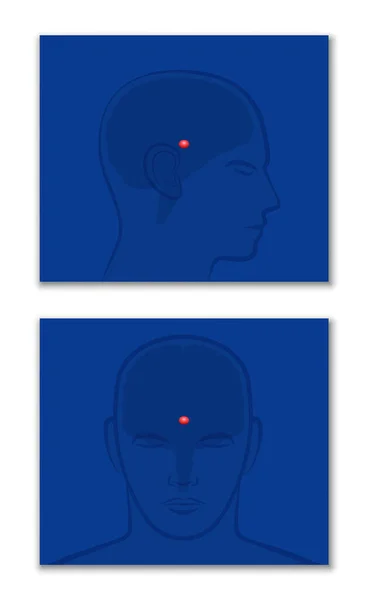 松果体 脑垂体 第三眼 在人脑中的位置的轮廓和正面视图 白色背景上的孤立矢量图解 — 图库矢量图片