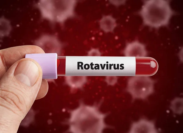 Rotavirus Koncept Vědec Drží Rotavirus Infikované Krve Zkumavky Před Viry Stock Snímky