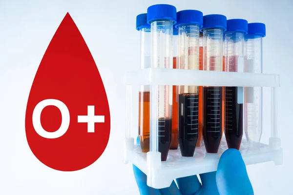 Blood type 0+. The logo of the first blood group. Rhesus factor is positive. Doctor holds test tubes with human blood. Plastic test tubes in a medic\'s hand. Lifeblood logo in the form of a drop