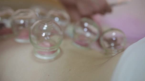 Uitzicht op Chinese Cupping Therapie, Tianjin, China — Stockvideo