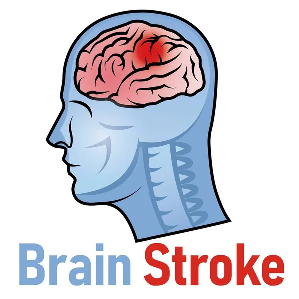 Kırmızı Epicenter ile Dünya Çarpışma Gününün Vektör İllüstrasyonu