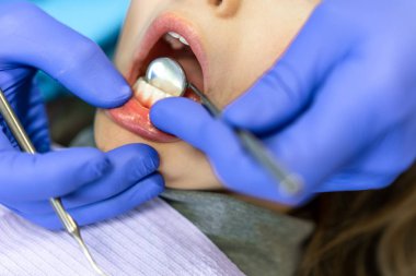 Diş Kliniği. Resepsiyon, hastanın incelenmesi. Diş Bakımı