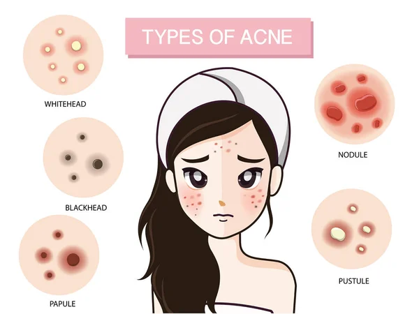 Tipo de menina de acne —  Vetores de Stock