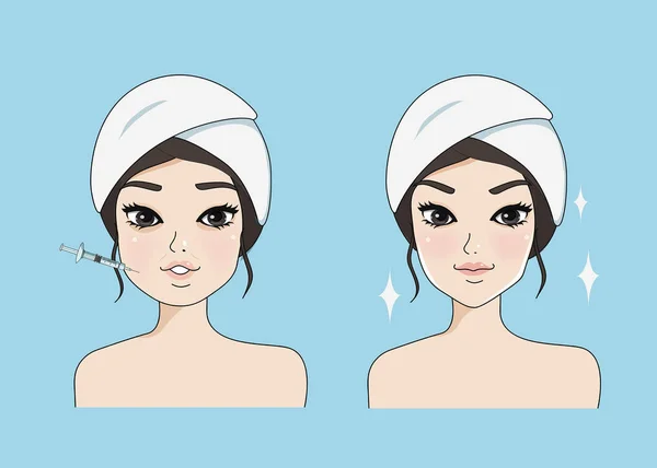 Chica botox — Vector de stock