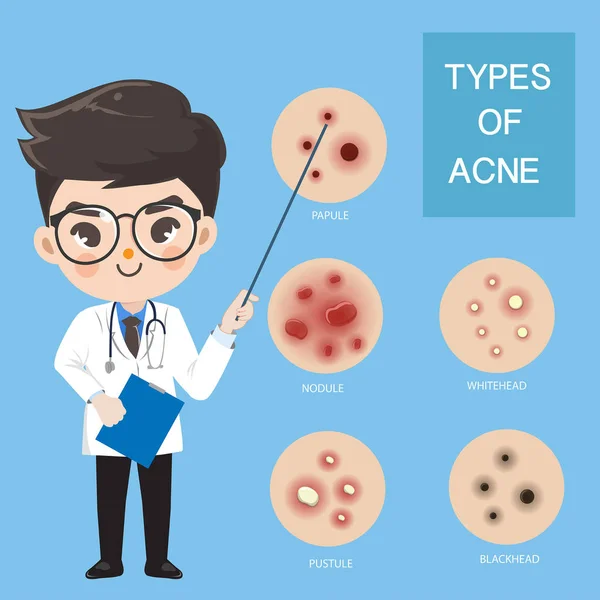 Os médicos recomendam tipagem de acne . — Vetor de Stock