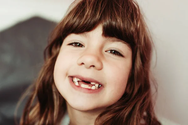 Retrato de cerca de una chica sin dientes frontales. Erupción de los dientes, dientes de bebé —  Fotos de Stock