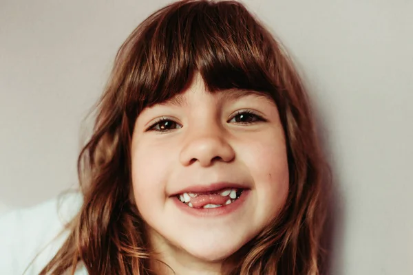 Close-up portrait of girl with no frontal teeth. Teeth eruption, baby teeth