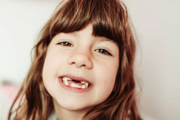 Retrato de cerca de una chica sin dientes frontales. Erupción de los dientes, dientes de bebé —  Fotos de Stock