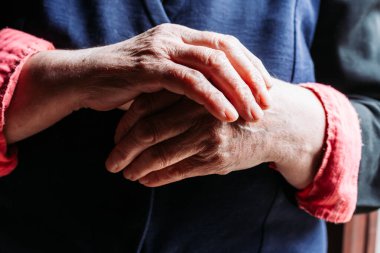 Yaşlı kadın elleri. Romatizma, artrit, eklem ağrısı.
