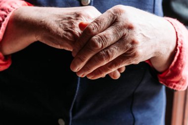 Yaşlı kadın elleri. Romatizma, artrit, eklem ağrısı.