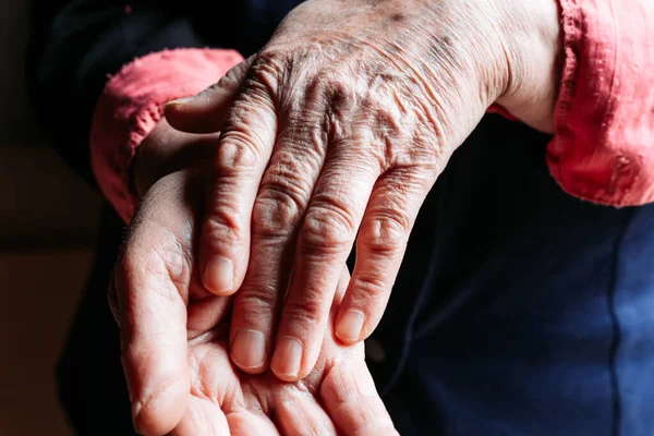 Foto ravvicinata di mani di donna anziana. Pelle rugosa — Foto Stock