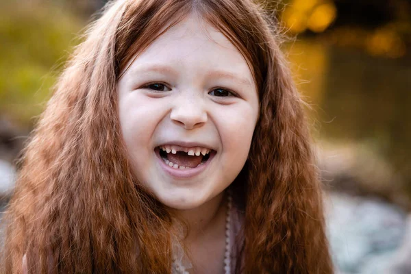 Adorable Niña Pelirroja Sonríe Muestra Los Dientes Delanteros Que Faltan —  Fotos de Stock