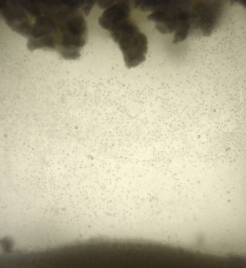 Sütü asitleşme süreci şaşırtıcı sahneleri tarafından eşlik ediyor. Asitleştirme sütü bakteriyel fermantasyon elde edilir