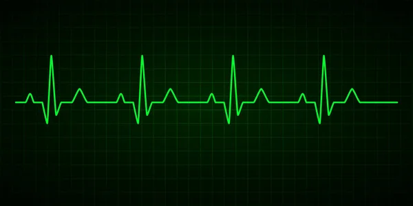 Heartbeat-raden. Kardiogram. Electrocardiogramen. Vektor illustration. — Stock vektor