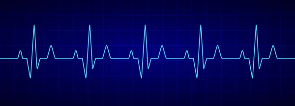 Battito cardiaco. Cardiogramma blu. Elettrocardiogramma. Illustrazione vettoriale . — Vettoriale Stock