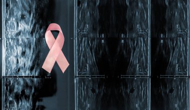 Bir mammografi arka planında pembe meme kanseri farkındalığı kurdelesi ultrasonda göğüs kanseri önleme kavramı