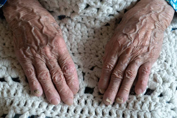 Händerna på en gammal kvinna 90 år närbild. — Stockfoto