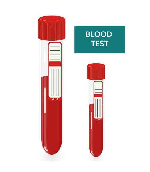 Análisis de sangre en tubo — Vector de stock