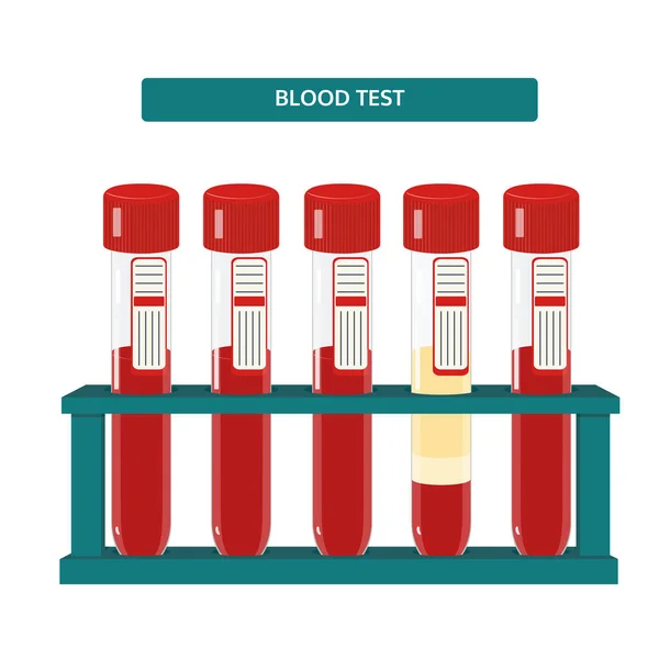 Tubos de análisis de sangre en rack . — Vector de stock