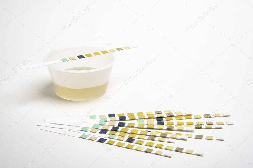 A piece of urine reagent test strip on top of a urine sample in a plastic container with a bunch of strips set in the foreground.