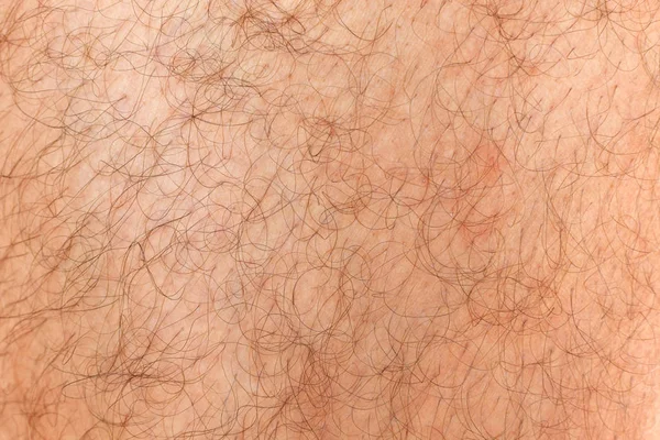 Perna Homem Peludo Fundo Fragmento Pele Coberto Cabelo Corpo Masculino — Fotografia de Stock