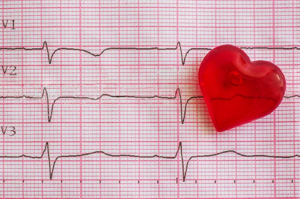 Elettrocardiogramma e cuore — Foto Stock