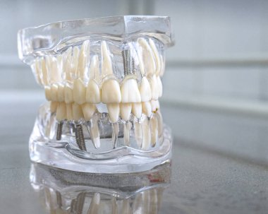 Oral hijyen eğitimi için akrilik insan çene modeli
