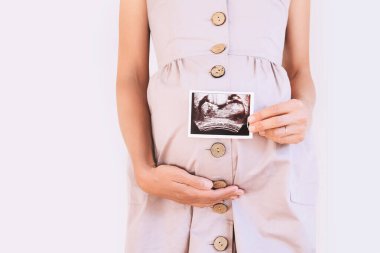 Ultrason bebek görüntüsü taşıyan hamile bir kadın. Annenin ellerinde hamile karnı ve ultrason fotoğrafı var. Hamilelik kavramı, jinekoloji, tıbbi test, annelik sağlığı.