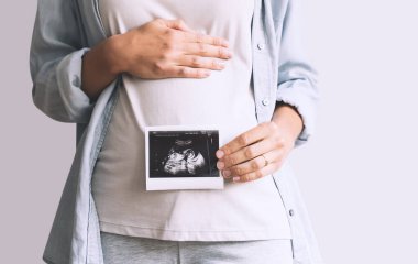 Ultrason bebek görüntüsü taşıyan hamile bir kadın. Annenin ellerinde hamile karnı ve ultrason fotoğrafı var. Hamilelik kavramı, jinekoloji, tıbbi test, annelik sağlığı.