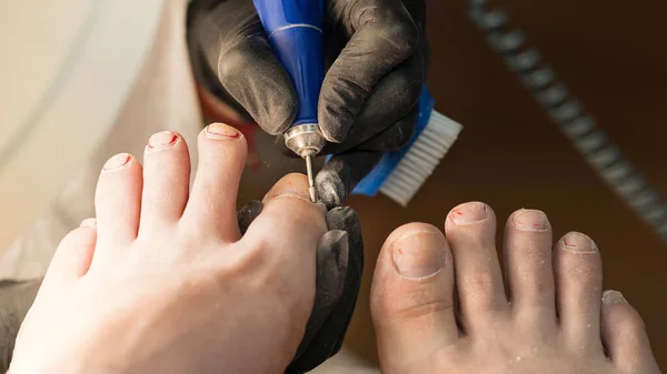 Hardware pedicure. Chiropody. Foot care.