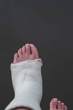 Ayak yaraları iyileşmesi için ayak bileği kayışı. Ayak bileği kayışı yaralanma önlemeye yardımcı olur, nesnelere odaklanmaz.