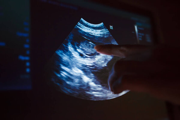 Снимок беременности собаки на экране монитора. Ветеринар указывает пальцем на беременность собаки. Ветеринарная концепция. Ветеринар делает УЗИ. Посмотреть щенка в собаке
.