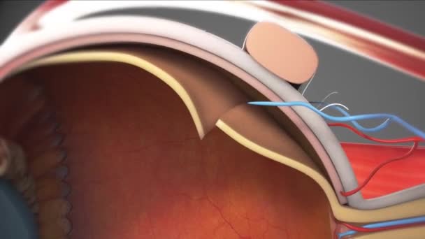 Animación médica del tratamiento con láser ocular sobre fondo azul — Vídeo de stock