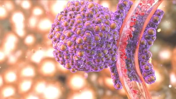 Tumorzellen, die Blut mit abnormalen Zellen füllen — Stockvideo