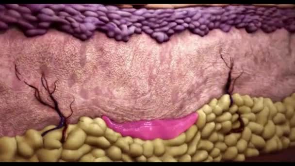Ліквідація потрібних зморшок і розтяжок на шкірі — стокове відео
