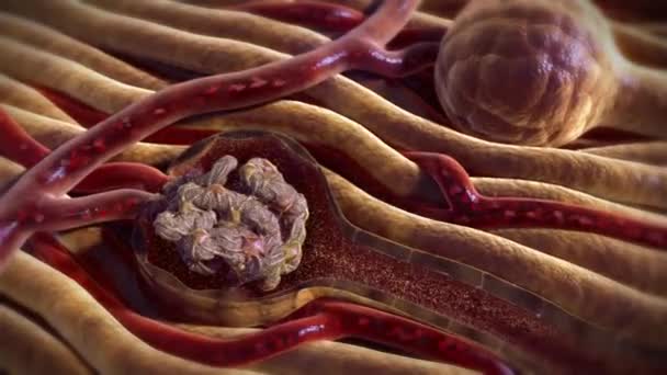 In the nephron, your blood is filtered by the tiny blood vessels of the glomeruli and then flows out of your kidney through the renal vein — Stock Video