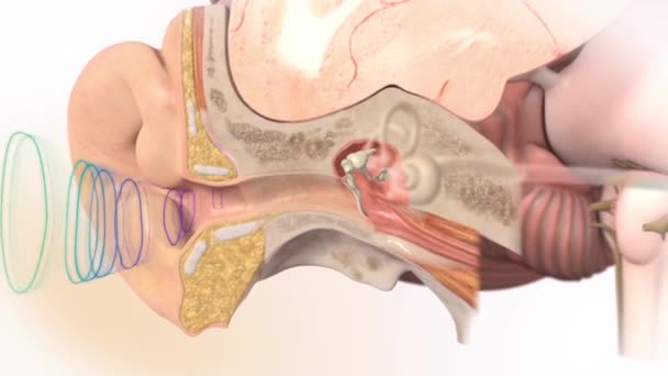 Animación médica 3D de la pérdida auditiva, anatomía en el oído — Vídeo de stock