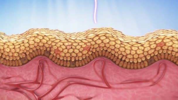 Szkodliwe działanie światła Uv na skórę — Wideo stockowe