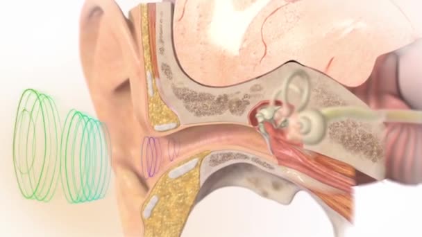 Animación médica 3D de la pérdida auditiva, anatomía en el oído — Vídeo de stock