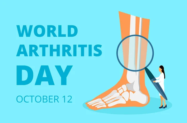 Día mundial de la artritis en octubre. Los médicos pequeños tratan el reumatismo, la osteoartritis. Cuidado de la salud vector concepto plano — Archivo Imágenes Vectoriales