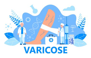 Tıbbi web sitesi için varis damarları konsept vektörü. Küçük cerrahlar, terapistler damar hastalıklarını tedavi eder, sıkı bandaj uygularlar..
