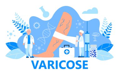 Varicose veins concept vector for medical website. Tiny surgeons, therapists treat vascular diseases, apply tight bandage. clipart