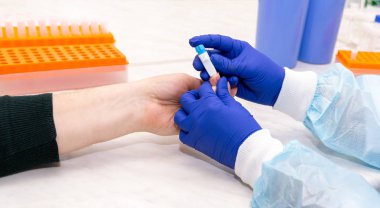 Virüsler için kan testi. Analiz için kan örneği alıyorum. Bir hemşire bir hastanın parmağından kan alır. Bir laboratuvar asistanının elinde kan örneklerini inceleyen bir korkuluk. Sınav yapılıyor.