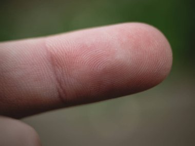 Kafkas Parmak Ucu Kapat