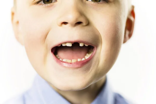 変な白い背景の上の少年の前歯なし口 — ストック写真