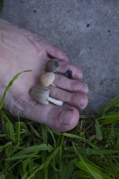 Na noze dospělé osoby mezi prsty rostou toadstooly. Houby na nohou. — Stock fotografie