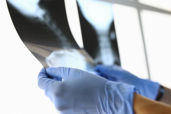 Doctor in gloves holds x-rays to light closeup. — Stock Photo, Image