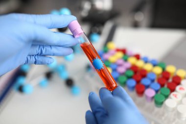 Eldivenli araştırmacı test tüpünü sıvı ile tutuyor..