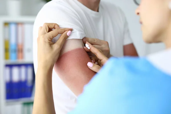 Nurse applies sunburn cream to patient closeup — Stock Photo, Image